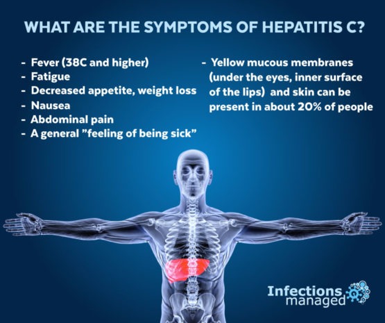 What Are The Symptoms Of Hepatitis C? | Infections Managed