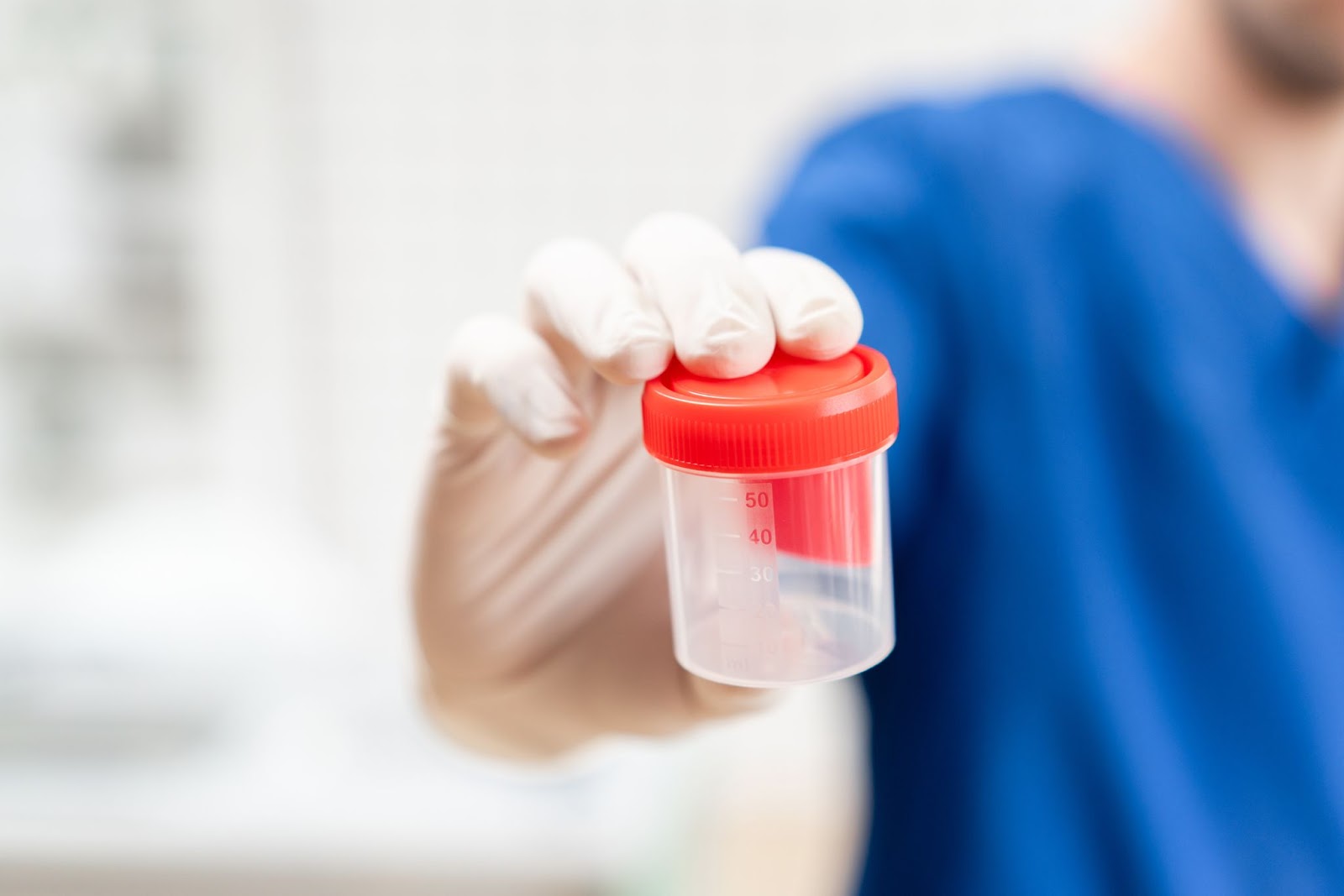 Doctor holding urine sample cup